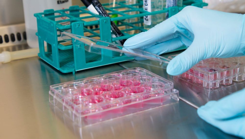 Alzheimer’s disease (AD) is a chronic neurodegenerative disorder characterized by progressive memory loss, drastic changes in personality and behavior, and in the latter stages the patients are unable to carry even simple daily activities. There is evidence that AD might be associated with bacteria residing in our intestine.